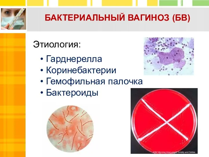 БАКТЕРИАЛЬНЫЙ ВАГИНОЗ (БВ) Этиология: Гарднерелла Коринебактерии Гемофильная палочка Бактероиды