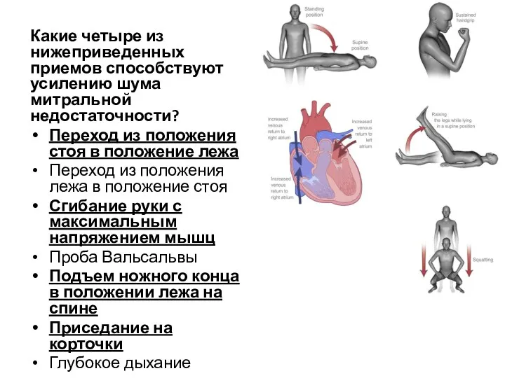 Какие четыре из нижеприведенных приемов способствуют усилению шума митральной недостаточности? Переход из