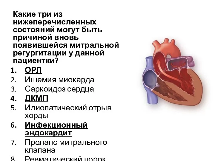 Какие три из нижеперечисленных состояний могут быть причиной вновь появившейся митральной регургитации