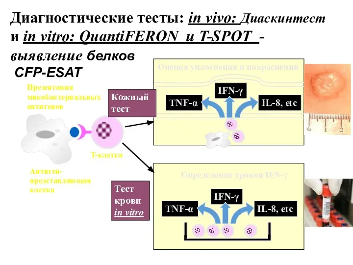 Диагностические тесты: in vivo: Диаскинтест и in vitro: QuantiFERON и T-SPOT - выявление белков CFP-ESAT