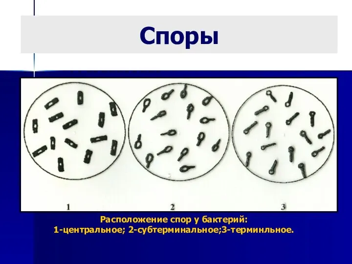Споры Расположение спор у бактерий: 1-центральное; 2-субтерминальное;3-терминльное.
