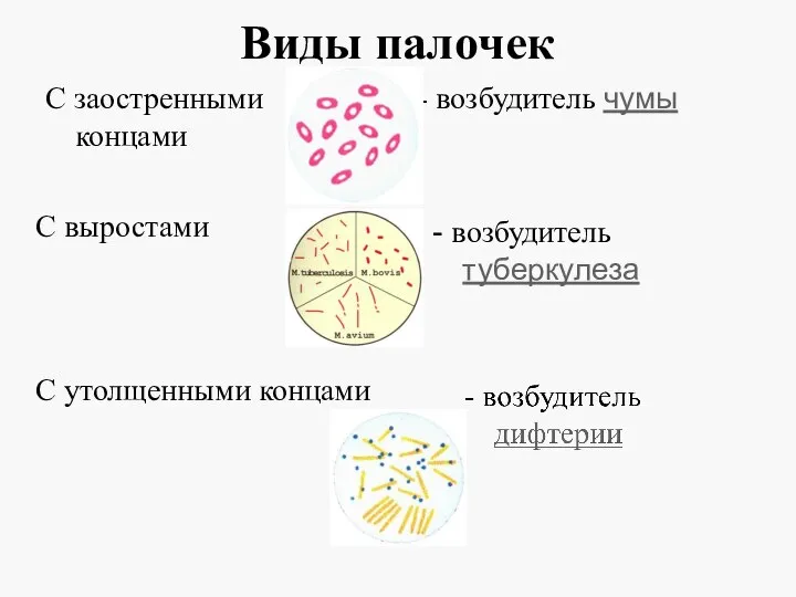 Виды палочек С заостренными концами - возбудитель чумы С выростами - возбудитель туберкулеза С утолщенными концами