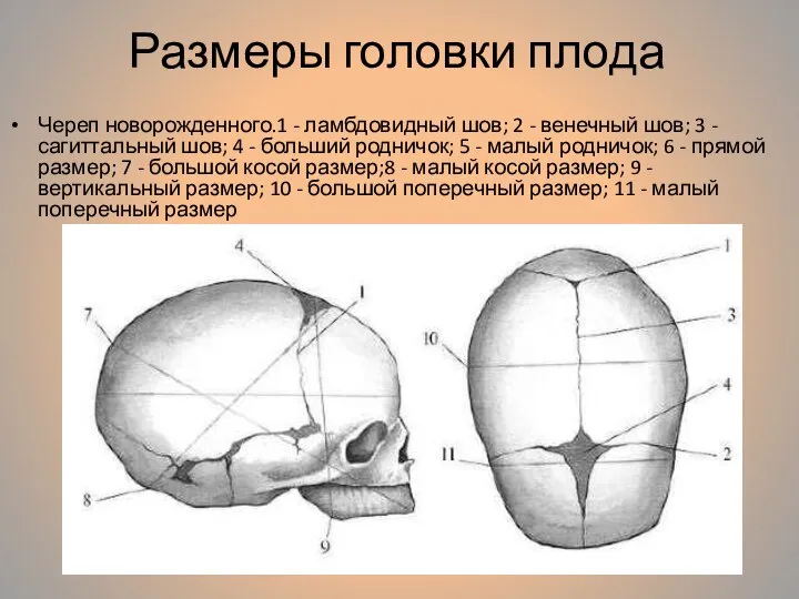 Размеры головки плода Череп новорожденного.1 - ламбдовидный шов; 2 - венечный шов;