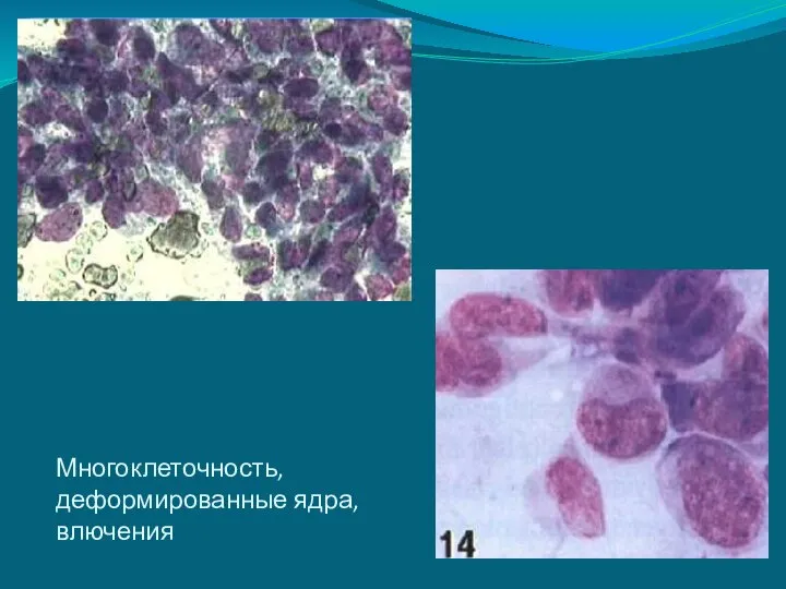 Многоклеточность, деформированные ядра, влючения