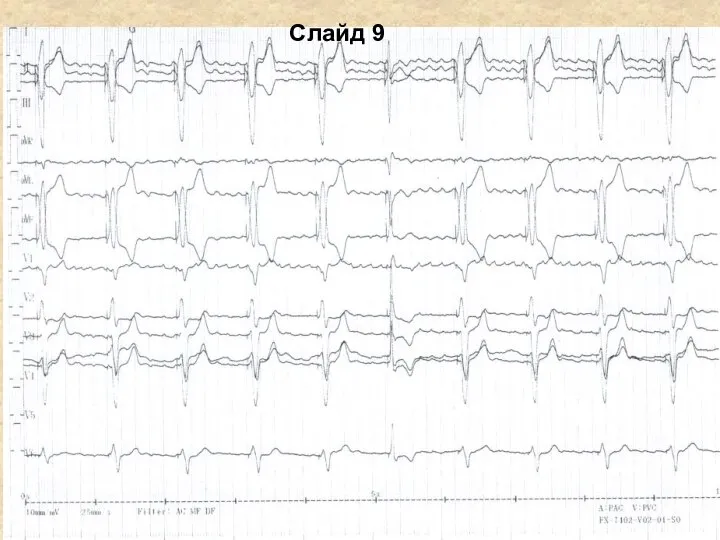 Слайд 9