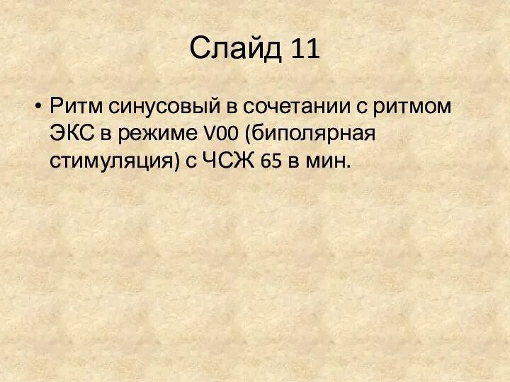 Слайд 11 Ритм синусовый в сочетании с ритмом ЭКС в режиме V00