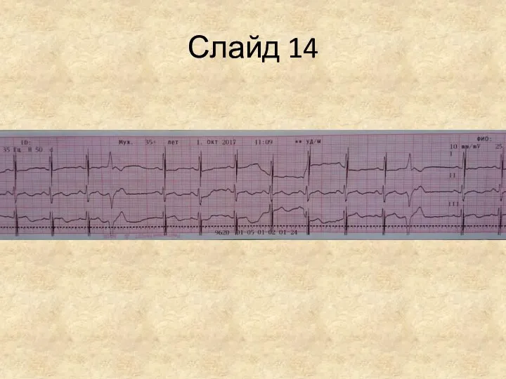 Слайд 14