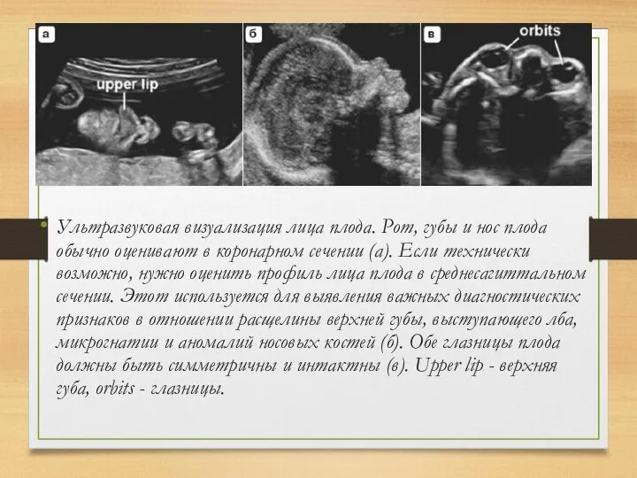 Ультразвуковая визуализация лица плода. Рот, губы и нос плода обычно оценивают в