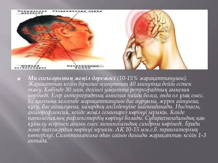 Ми соғылуының жеңіл дәрежесі (10-15% жарақаттанушы). Жарақаттан кейін бірнеше минуттан 40 минутқа