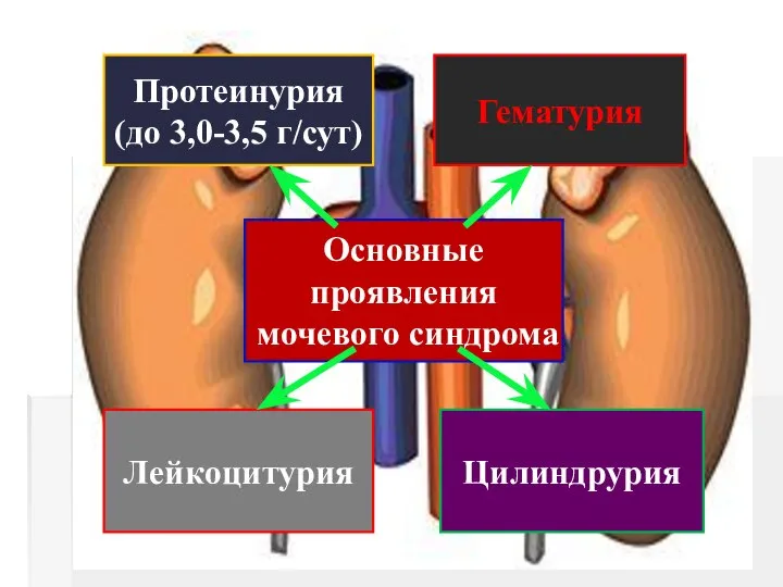 Основные проявления мочевого синдрома Протеинурия (до 3,0-3,5 г/сут) Гематурия Лейкоцитурия Цилиндрурия