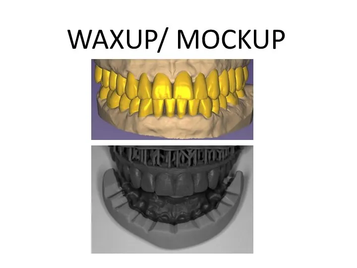 WAXUP/ MOCKUP