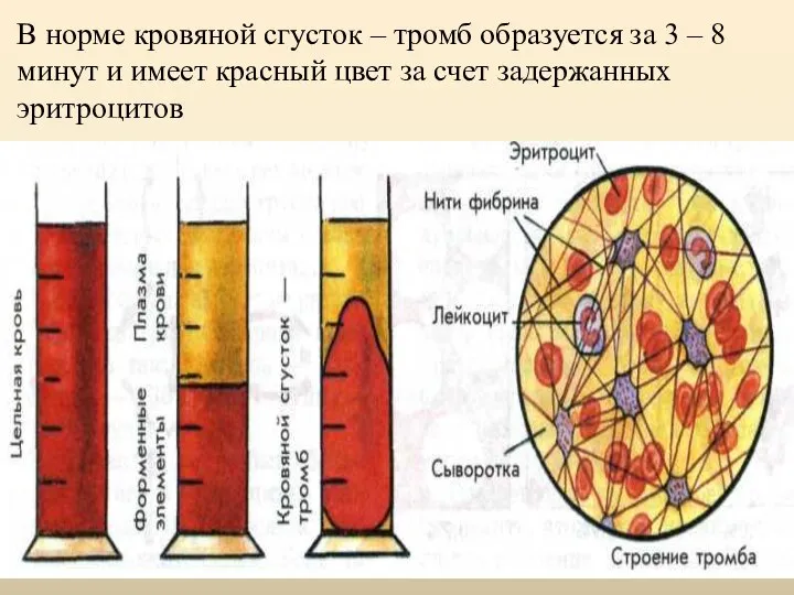 В норме кровяной сгусток – тромб образуется за 3 – 8 минут