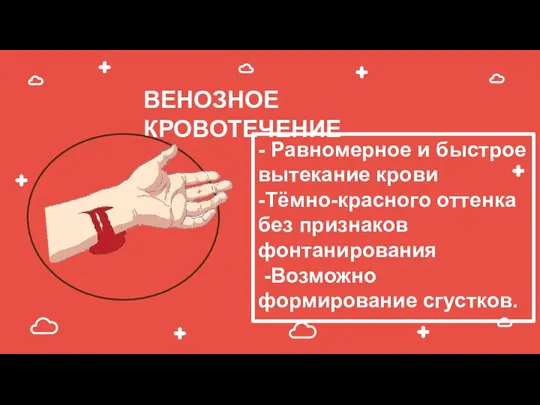 ВЕНОЗНОЕ КРОВОТЕЧЕНИЕ - Равномерное и быстрое вытекание крови -Тёмно-красного оттенка без признаков фонтанирования -Возможно формирование сгустков.