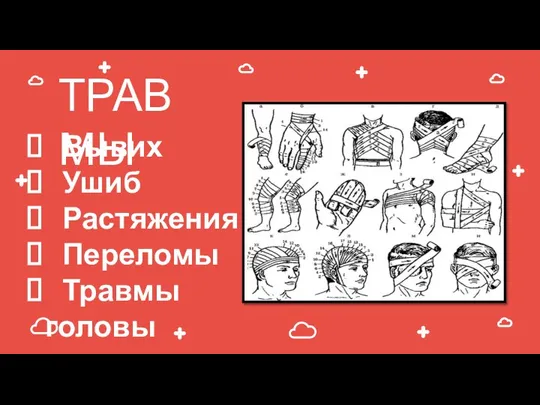 ТРАВМЫ Вывих Ушиб Растяжения Переломы Травмы головы