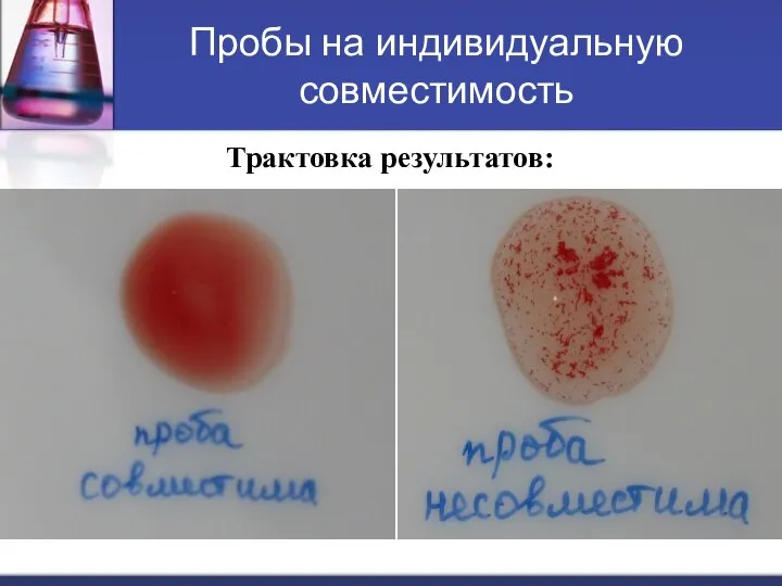 Пробы на индивидуальную совместимость Трактовка результатов: