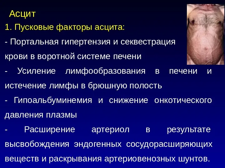 Асцит 1. Пусковые факторы асцита: - Портальная гипертензия и секвестрация крови в