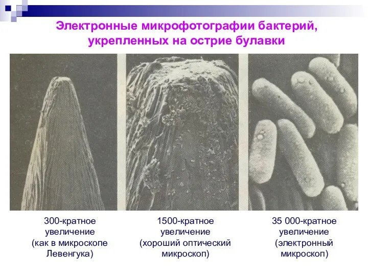 Электронные микрофотографии бактерий, укрепленных на острие булавки 300-кратное увеличение (как в микроскопе