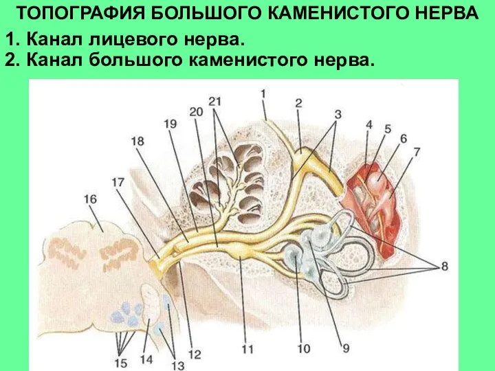 ТОПОГРАФИЯ БОЛЬШОГО КАМЕНИСТОГО НЕРВА 1. Канал лицевого нерва. 2. Канал большого каменистого нерва.