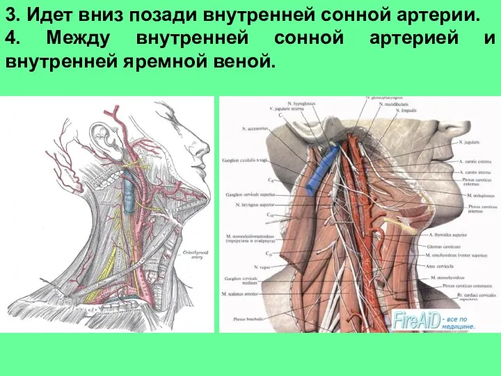 3. Идет вниз позади внутренней сонной артерии. 4. Между внутренней сонной артерией и внутренней яремной веной.