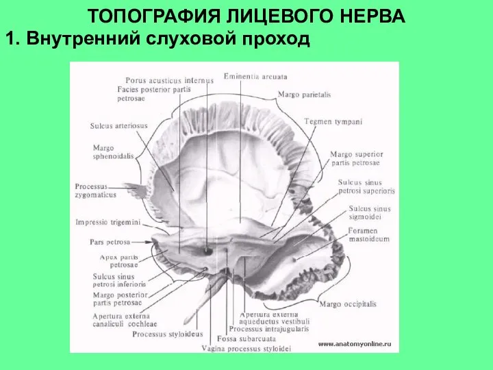 ТОПОГРАФИЯ ЛИЦЕВОГО НЕРВА 1. Внутренний слуховой проход