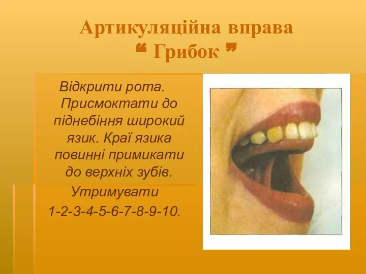 Артикуляційна вправа “ Грибок ” Відкрити рота. Присмоктати до піднебіння широкий язик.