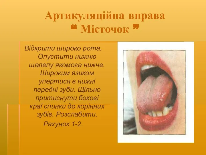 Артикуляційна вправа “ Місточок ” Відкрити широко рота. Опустити нижню щелепу якомога