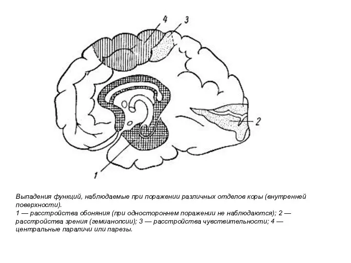 Выпадения функций, наблюдаемые при поражении различных отделов коры (внутренней поверхности). 1 —