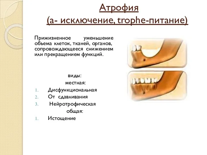 Атрофия (а- исключение, trophe-питание) Прижизненное уменьшение объема клеток, тканей, органов, сопровождающееся снижением