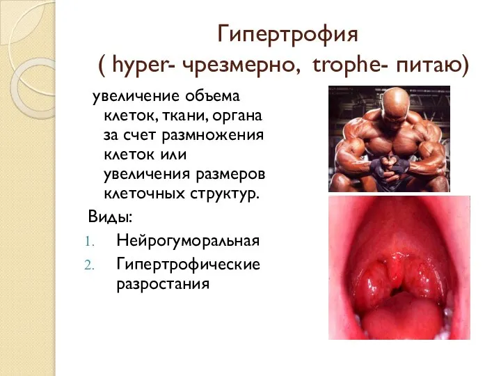 Гипертрофия ( hyper- чрезмерно, trophe- питаю) увеличение объема клеток, ткани, органа за