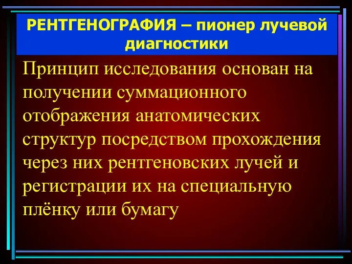 РЕНТГЕНОГРАФИЯ – пионер лучевой диагностики Принцип исследования основан на получении суммационного отображения