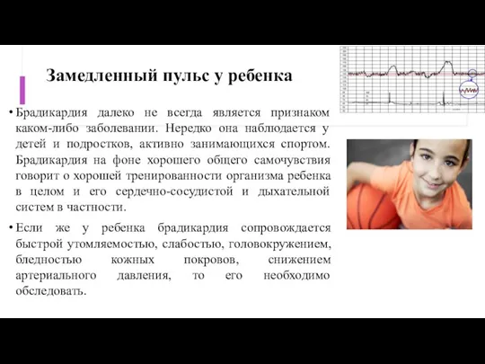 Замедленный пульс у ребенка Брадикардия далеко не всегда является признаком каком-либо заболевании.