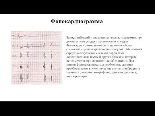 Запись вибраций и звуковых сигналов, издаваемых при деятельности сердца и кровеносных сосудов.