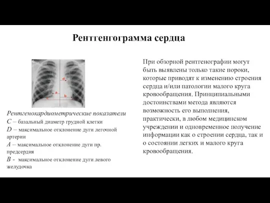 Рентгенгограмма сердца При обзорной рентгенографии могут быть выявлены только такие пороки, которые