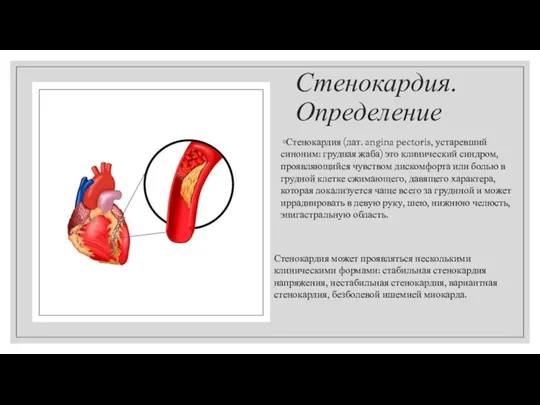 Стенокардия. Определение Стенокардия (лат. angina pectoris, устаревший синоним: грудная жаба) это клинический