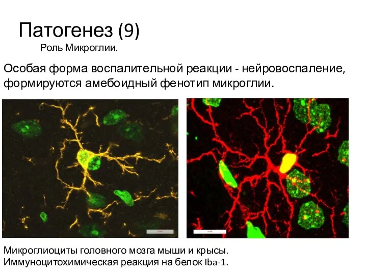 Патогенез (9) Роль Микроглии. Микроглиоциты головного мозга мыши и крысы. Иммуноцитохимическая реакция