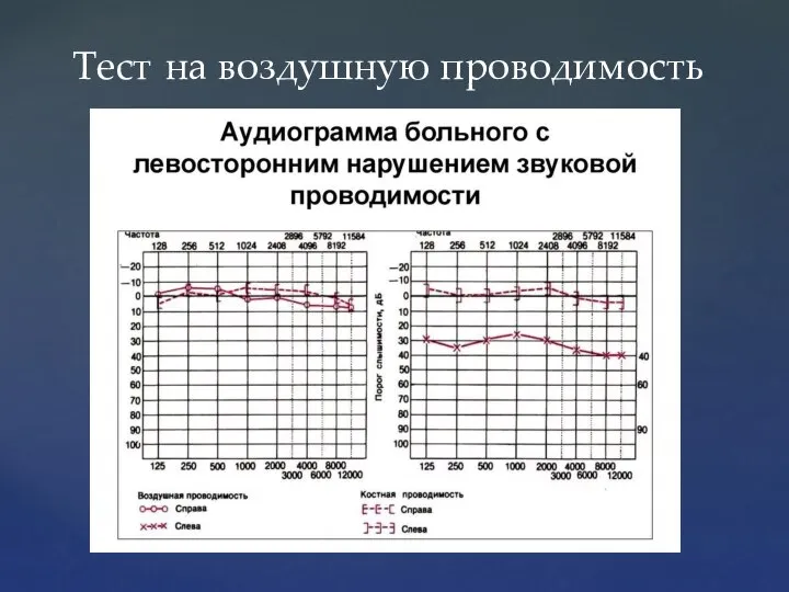 Тест на воздушную проводимость