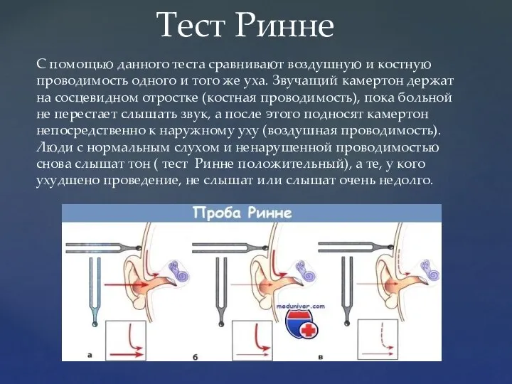 С помощью данного теста сравнивают воздушную и костную проводимость одного и того