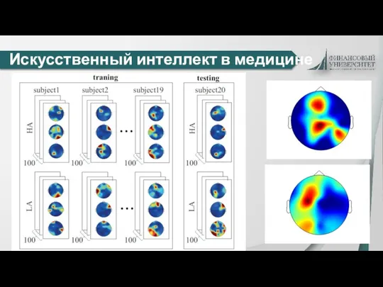 Искусственный интеллект в медицине