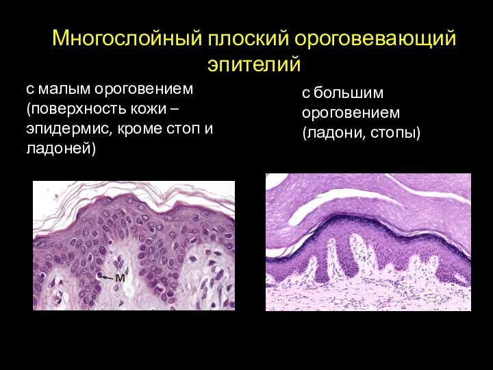 Многослойный плоский ороговевающий эпителий с малым ороговением (поверхность кожи – эпидермис, кроме