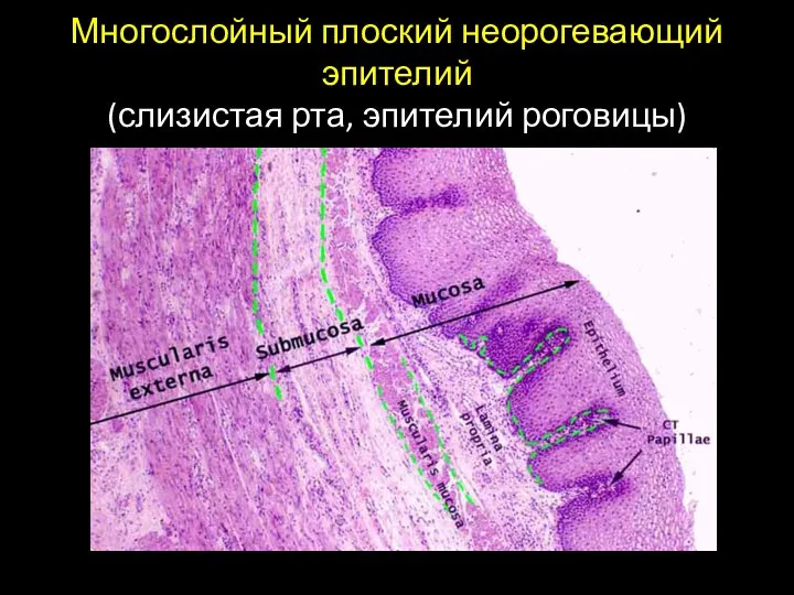 Многослойный плоский неорогевающий эпителий (слизистая рта, эпителий роговицы)