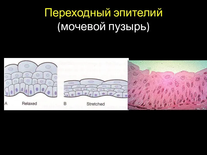 Переходный эпителий (мочевой пузырь)