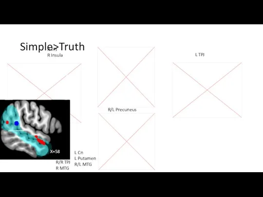 Simple>Truth L R L X=45 R/L Precuneus L TPJ R TPJ R