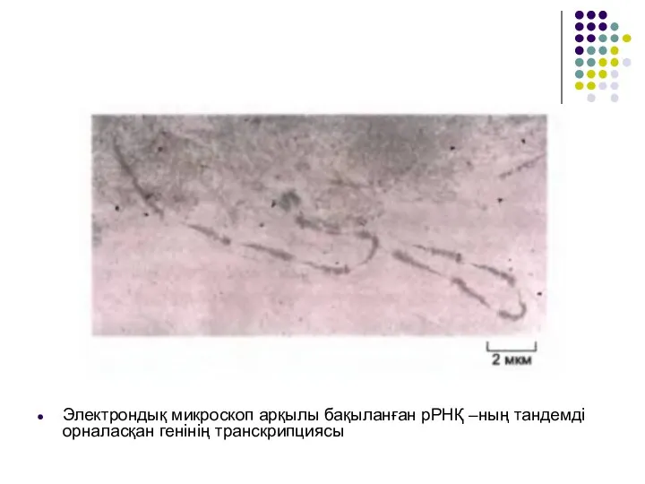 Электрондық микроскоп арқылы бақыланған рРНҚ –ның тандемді орналасқан генінің транскрипциясы