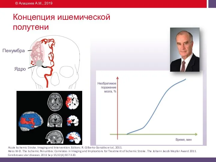 Концепция ишемической полутени © Алашеев А.М., 2019 Acute Ischemic Stroke. Imaging and