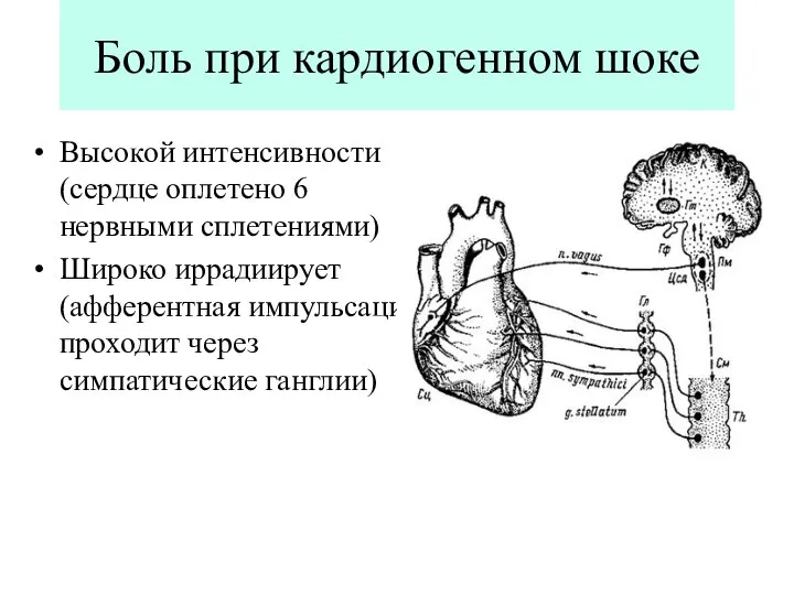 Боль при кардиогенном шоке Высокой интенсивности (сердце оплетено 6 нервными сплетениями) Широко