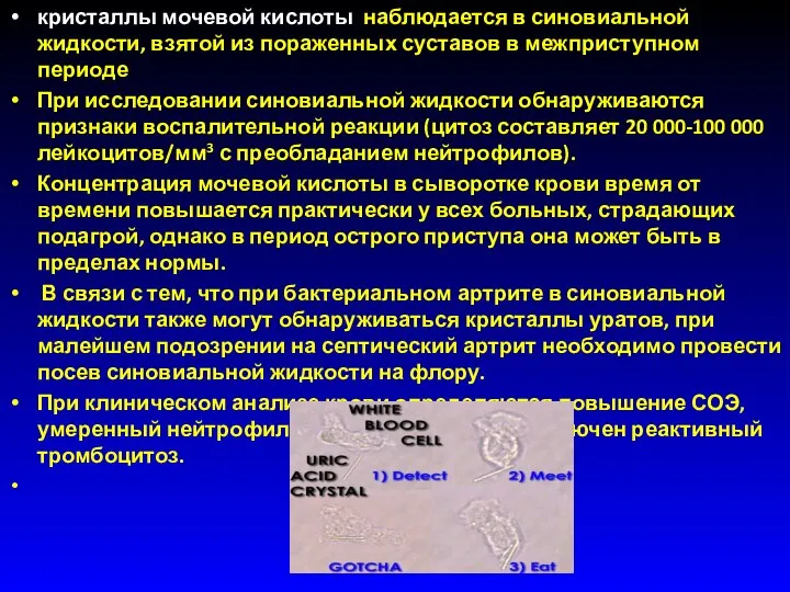 кристаллы мочевой кислоты наблюдается в синовиальной жидкости, взятой из пораженных суставов в