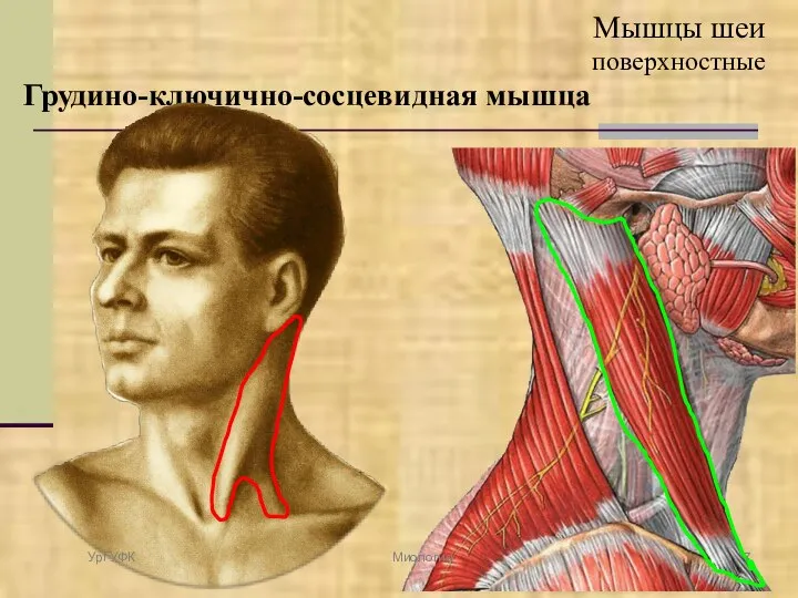 Грудино-ключично-сосцевидная мышца Мышцы шеи поверхностные УрГУФК Миология