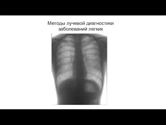 АКТУАЛЬНЫЕ ВОПРОСЫ РЕНТГЕНОЛОГИИ Методы лучевой диагностики заболеваний легких