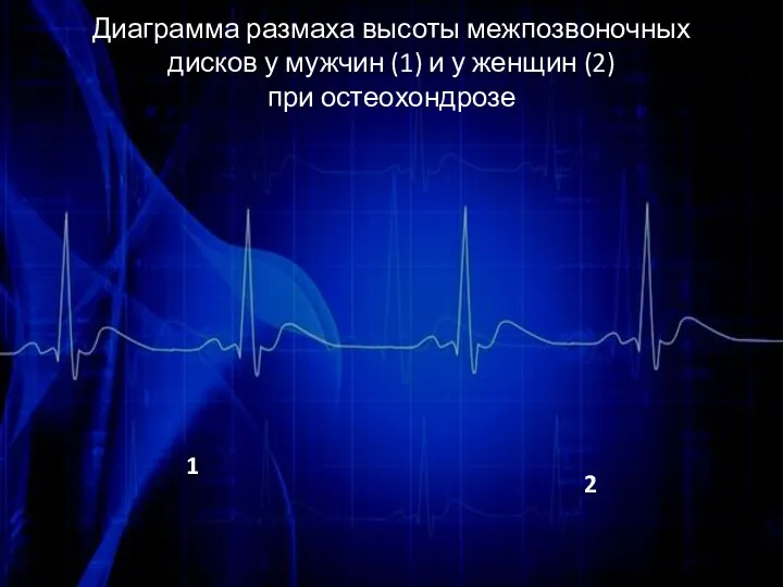 Диаграмма размаха высоты межпозвоночных дисков у мужчин (1) и у женщин (2) при остеохондрозе 1 2