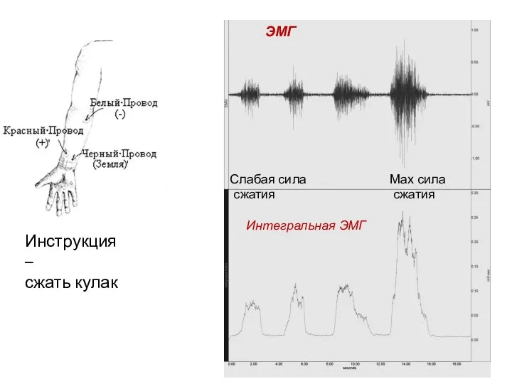 Слабая сила сжатия Мах сила сжатия Инструкция – сжать кулак ЭМГ Интегральная ЭМГ